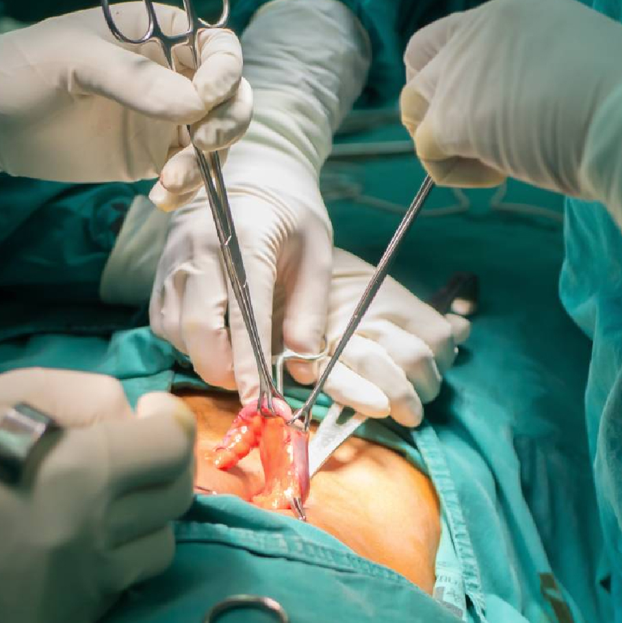 Resultado Apendicectomía 3