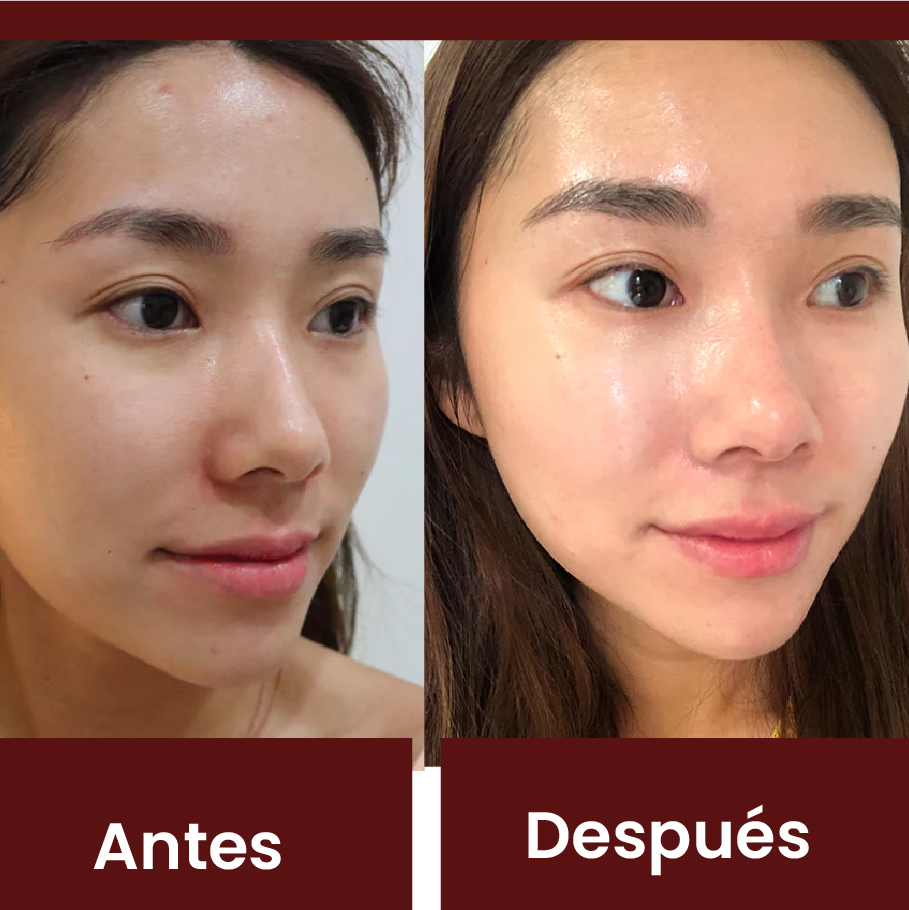 Resultado Exosomas 1