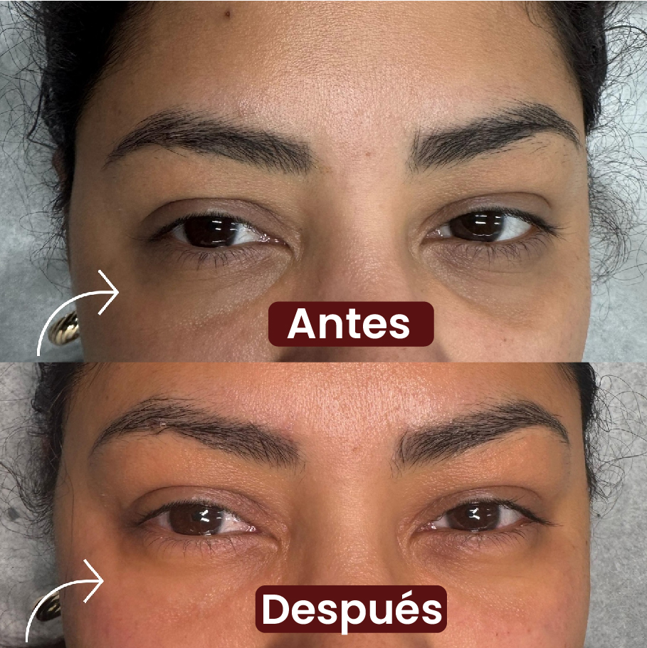 Resultado Exosomas 3