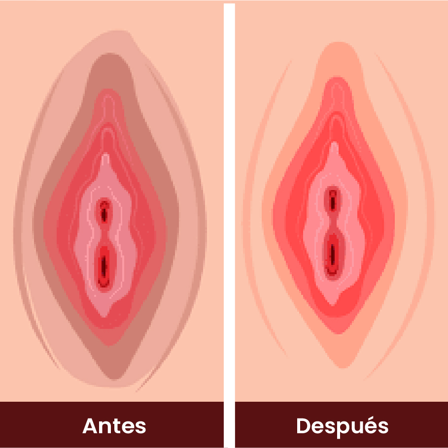 Resultado 2