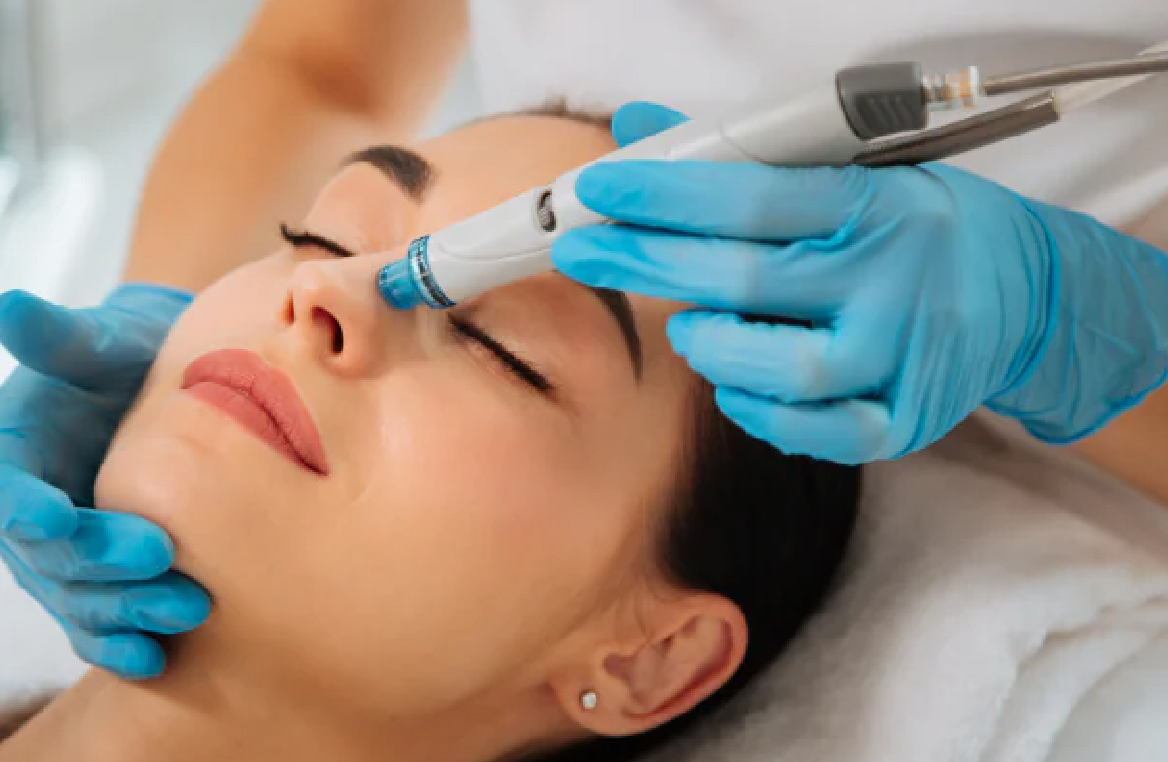 Hydrafacial 1
