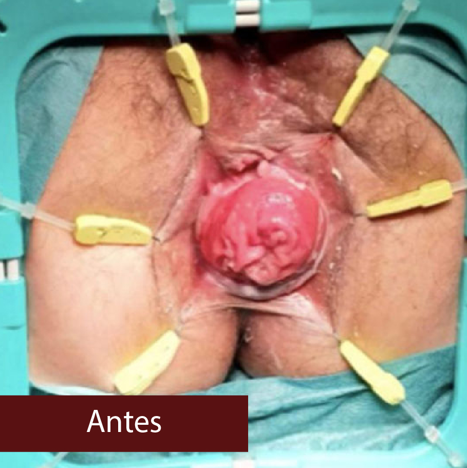 Resultado 1