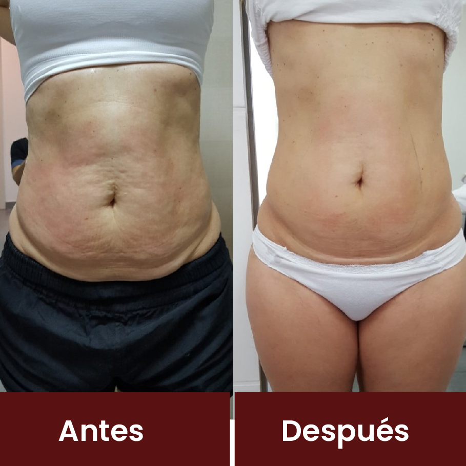 Resultado Revisional 3