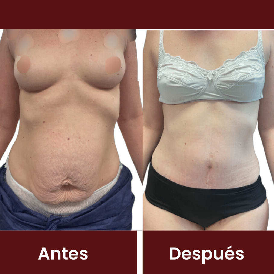 Resultado Revisional 1