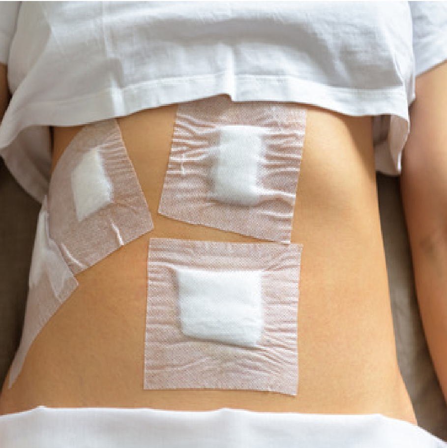 Resultado Vesícula 3