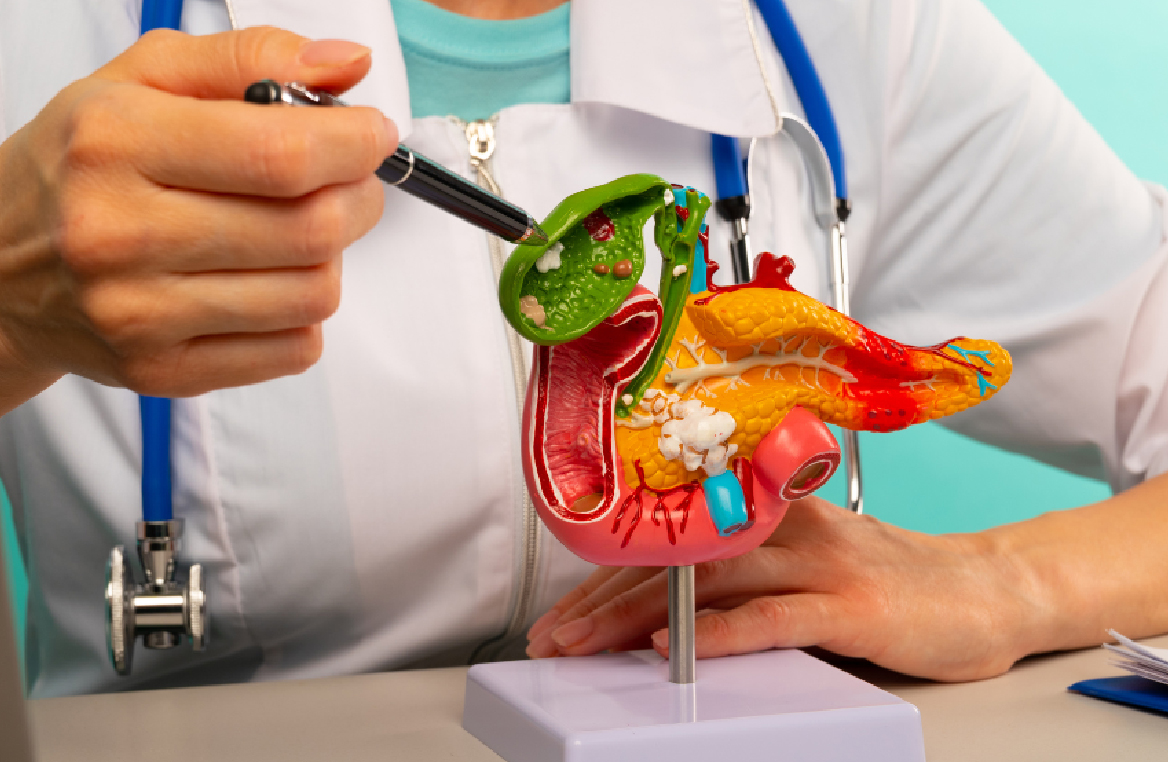 Resultado Vesícula 1